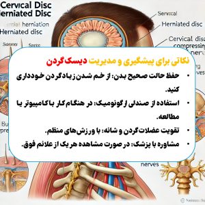 پیشگیری از دیسک گردن 