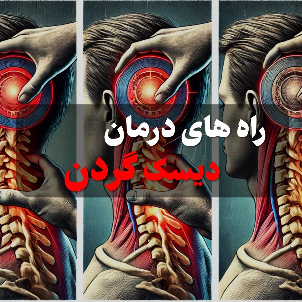 راه های درمان دیسک گردن به صورت جراحی و غیر جراحی