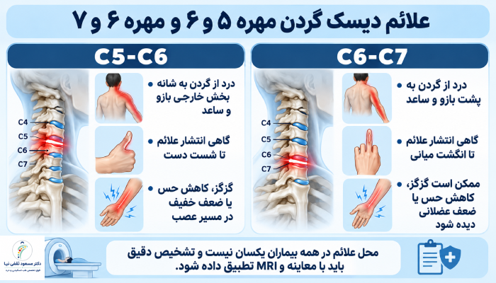 علائم دیسک گردن مهره ۵ و ۶ چیست؟