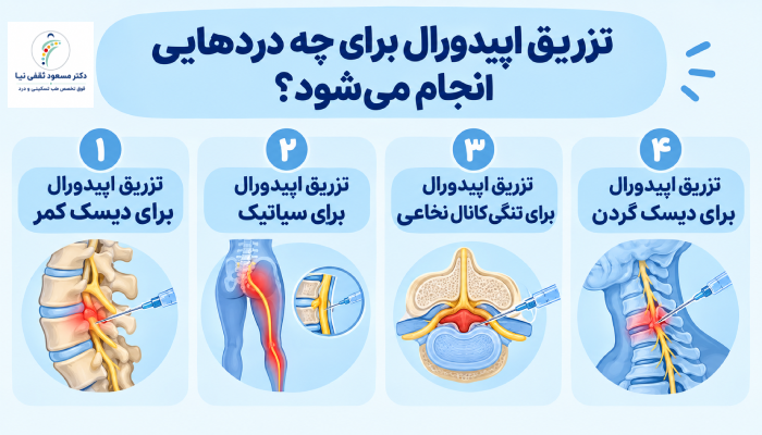 تزریق اپیدورال برای چه دردهایی انجام می‌شود؟