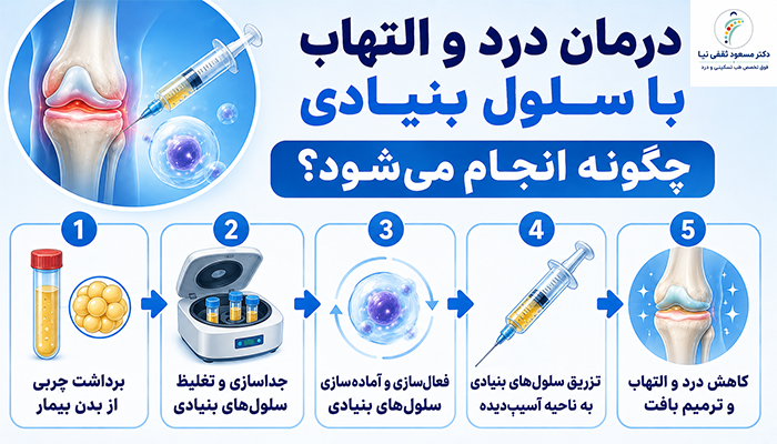 درمان درد و التهاب با سلول بنیادی چگونه انجام می‌شود؟