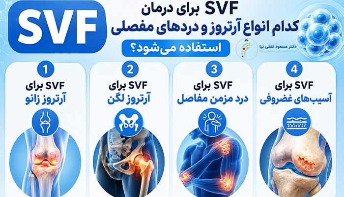 SVF برای درمان کدام انواع آرتروز و دردهای مفصلی استفاده می‌شود؟