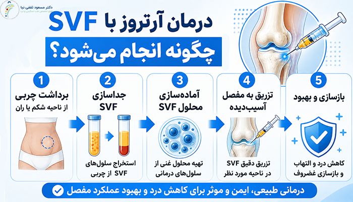 درمان آرتروز با SVF چگونه انجام می‌شود؟