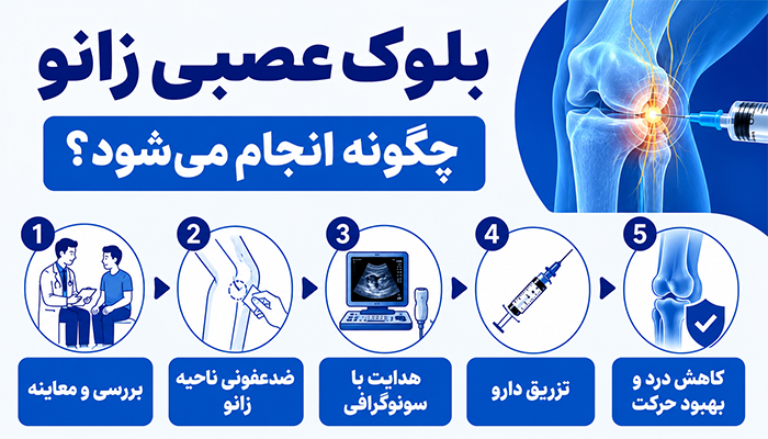 بلوک عصبی زانو چگونه انجام می‌شود؟