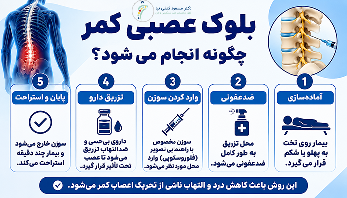 بلوک عصبی کمر چگونه انجام می‌شود؟
