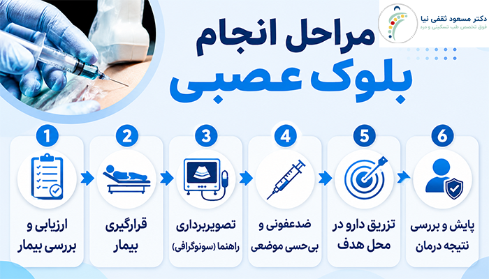 مراحل انجام بلوک عصبی