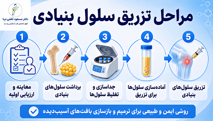 مراحل تزریق سلول بنیادی