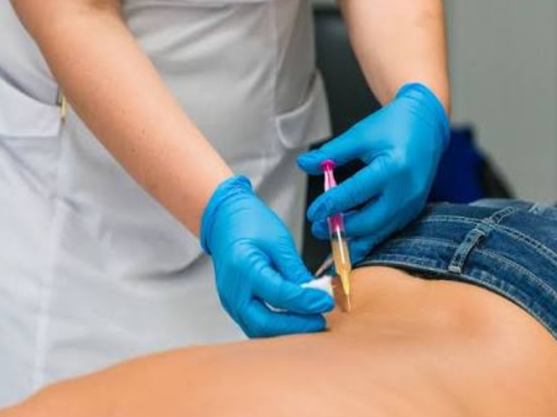 اوزون‌تراپی دیسک کمر